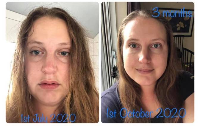 Sarah - day one and then 3 months without alcohol - changes in face are amazing